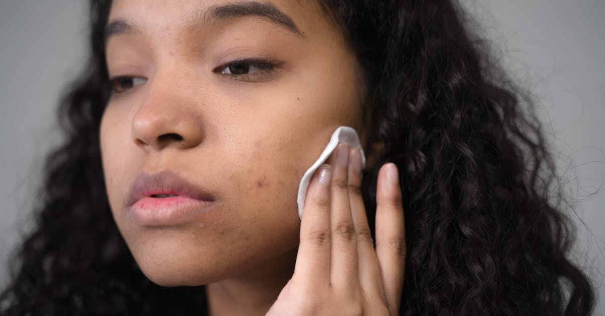 Wart Removal At Home
