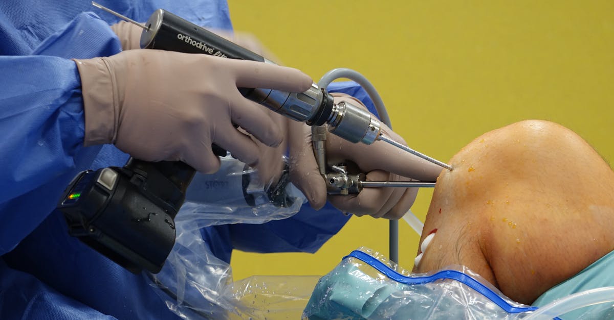 Revolutionary Knee Replacement Tech