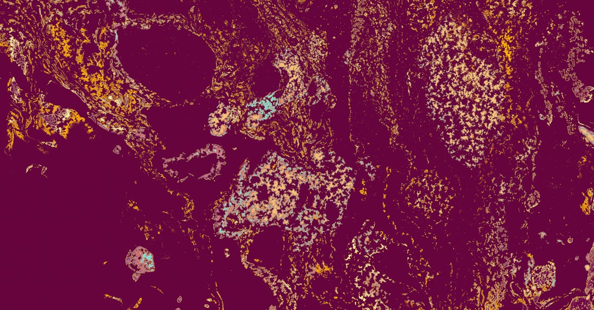 Polyendocrine Metabolic Ovary Syndrome: A New Era